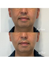 シーズボーテ(C's Beaute)/男性も若見えリフトUP♪