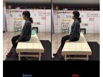 ストレチックス 近江八幡店/BeforeAfter