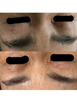 アースコアフュールボーテ 佐野新都市店(EARTH coiffure beaute)/眉毛アイブロウIPL光shot脱毛!