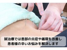 あさひろ鍼灸整骨院 新宿院/【鍼施術】全身のツボを選穴