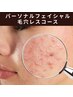 【8月限定】【毛穴デトックス★根本ニキビケアに◎】パーソナルコース¥6,600