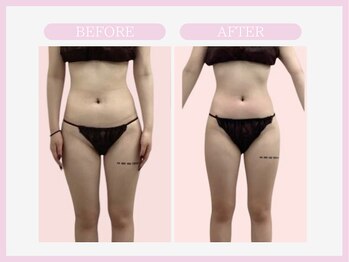 スリムライン 山形店(The Slim Line)/before→after