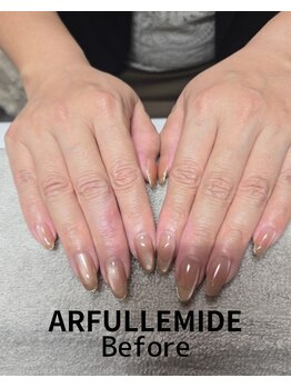 シュルーネイル(Shul-Nail)/ARFULLEMIDE トリートメント