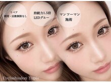 ユピス(Yupis)
