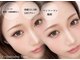 ユピス(Yupis)の写真