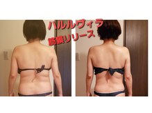 ハルルヴィラ (Haluluvilla)の雰囲気（短期間でくびれ、ヒップアップ本気ダイエット！筋膜リリース）