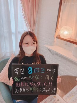 エクボ(EcBeau)/顔脱毛8回目！Eライト顔脱毛