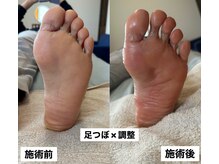 サロン サルー(SALON Salud)/◇足つぼ×調整