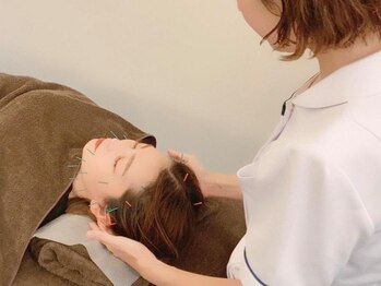 広島整体院 アンド 美容鍼の写真/美容鍼と頭蓋骨へアプロ-チ!自分の顔が好きになる小顔矯正◎全スタッフ国家資格保持者（はり師・きゅう師）