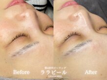 リル 和歌山市店(lilou)/ララピールBefore After！