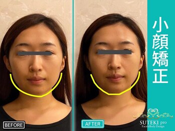 美骨矯正 ステキプロ(SUTEKI pro)の写真/たるみ・むくみ・顔まわりのもたつきに◎通うたび小顔実感★花嫁さん・30~40代からの大人女子にも好評＊