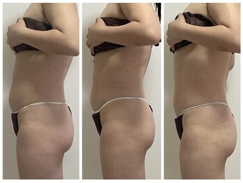 リュクス(LUXE)/30代のママもぽっこりお腹卒業!