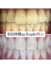ホワイトニングルーム 横浜店(Whitening Room)/ホワイトニング/横浜