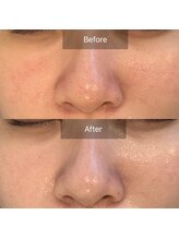 ラリュンヌ(La Lune)/