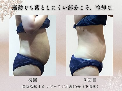 アバンダンティア 姫路店の写真