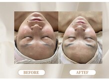 トロワ(TROIS)/一回でもわかる圧倒的結果