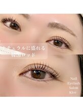 クレー(Klee)/バターロッド