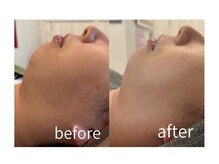 ルビーサロン(ruby-salon)の雰囲気（熟練手技で引き締まった印象に[西脇市/リフトアップ/たるみケア]）