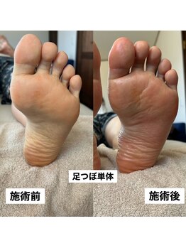 サロン サルー(SALON Salud)/◇足つぼ
