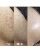 リュクス  Luxe＋tkm 南船場 ボディ ハーブ