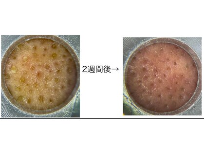 アミュレット(AMULET)の写真