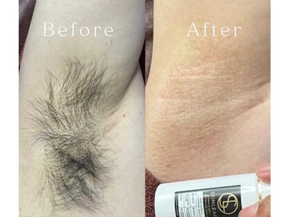 スキンリープワックスサロン 川崎店(SKINLEAP Wax salon)の写真