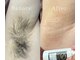 スキンリープワックスサロン 川崎店(SKINLEAP Wax salon)の写真