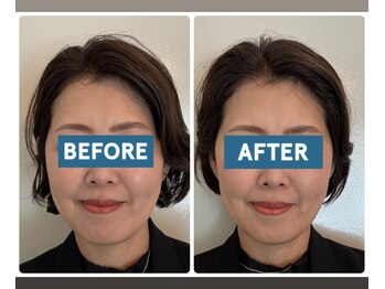 ル メルシェ(Lemerci)/初回 &nbsp;&nbsp;&nbsp;before &nbsp;&nbsp;after！