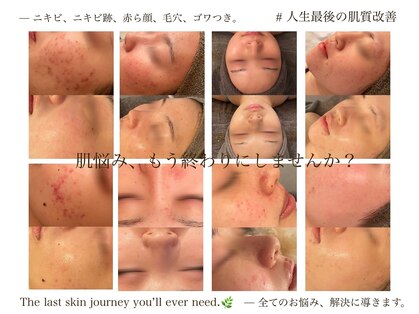 ビジュープラス(Bijou+)の写真
