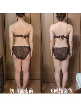 ルマ(Rumah)/広がった肩幅は筋肉で変わります