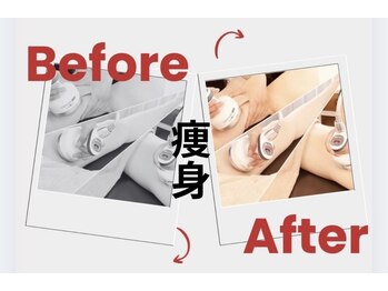 トレゾール(tresor)/Before/After