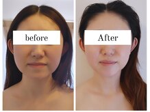 ココエール(COCOYELL)