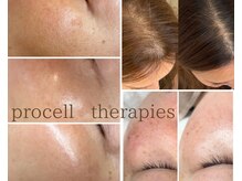 レア(le'a)の雰囲気（変化に驚きの声続出！最速の変化でなりたい自分に♪肌質／頭皮◎）