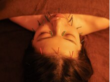 はりうさぎの雰囲気（美容鍼灸/育毛促進鍼/お身体の鍼灸）