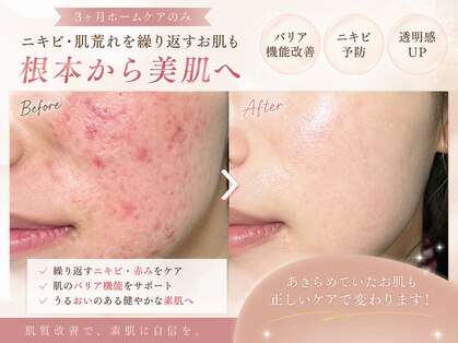 ウェルビーイング(well-being)の写真