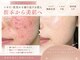 ウェルビーイング(well-being)の写真