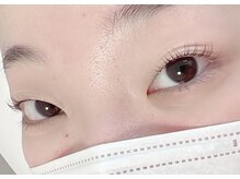 シェリー(Cheri)/ダブルアイリフト