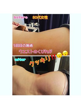 ルミネ(Lumine)/お腹周りが気になる方へぜひ！！