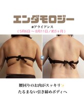 アイリス(AIRIS)/痩身/リンパケア/マッサージ