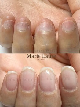 マリーロール 淀屋橋本店(Marie Laure)/自爪育成/深爪矯正/ネイルケア