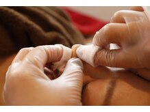 オゾンレメディ(O3remedy)/毛穴洗浄