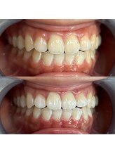 ライトビューティー 池袋店(LightBeauty)/症例写真