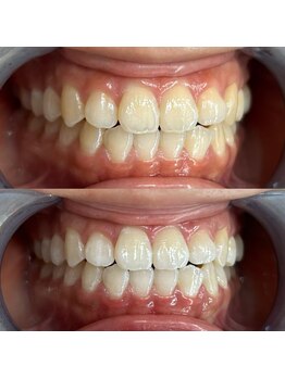 ライトビューティー 池袋店(LightBeauty)/症例写真