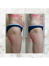 ヨサパーク エトワール 聖蹟桜ヶ丘店(YOSAPARK)/before、after♪