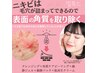 【ニキビでお悩みの方へ】韓国式最強ニキビケア￥７,980