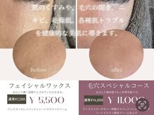 エステティック バイ イム(esthetic by im)