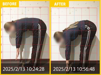 整体院 元 宇城松橋店/首や肩の痛みの悩み