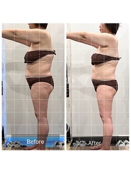 プリューム(PLUME)/本気痩せリンパマッサージ150分