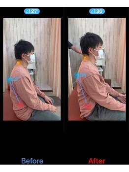 うらら整骨院/姿勢が1回の施術でこんなに変化