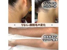 アールビューティ(R beauty)の雰囲気（オーダーメイド高速美肌脱毛!毛をなくすだけでなく美肌も叶う◎）